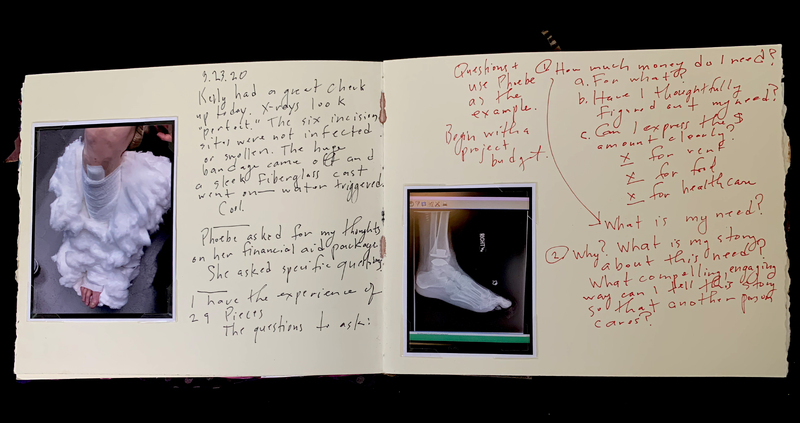 A journal entry with handwritten notes, a photograph of a person with a cast, and an X-ray image of a foot.