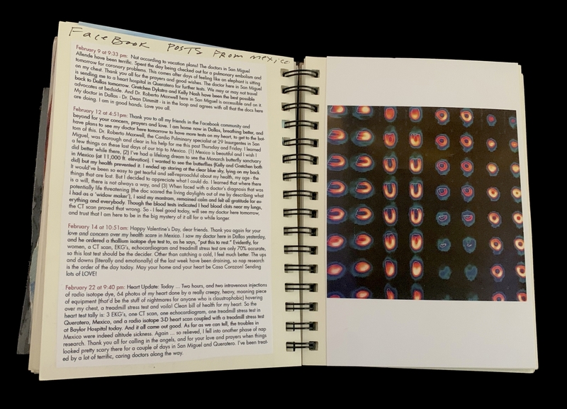 A spiral-bound notebook page with handwritten text and a photograph of a medical scan.
