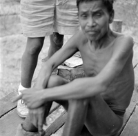 "KT Leprosy ", picture of an old man, shirtless, sitting on the floor